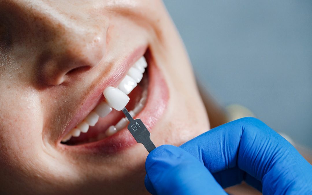 Estetica Dentale
