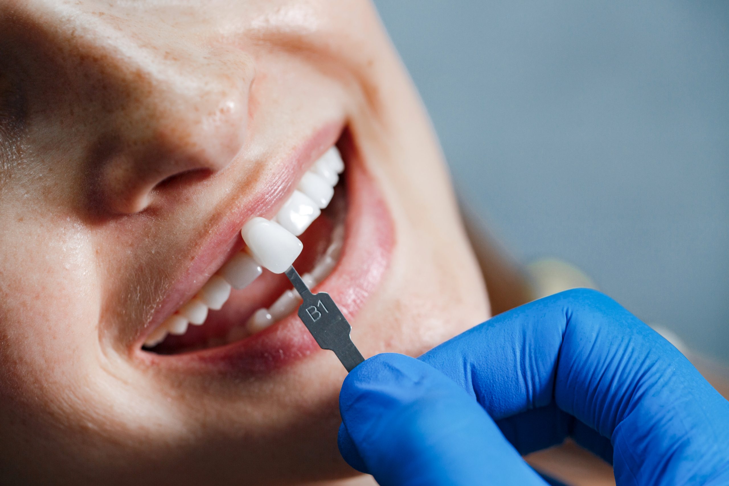Estetica Dentale-stomadent-trapani