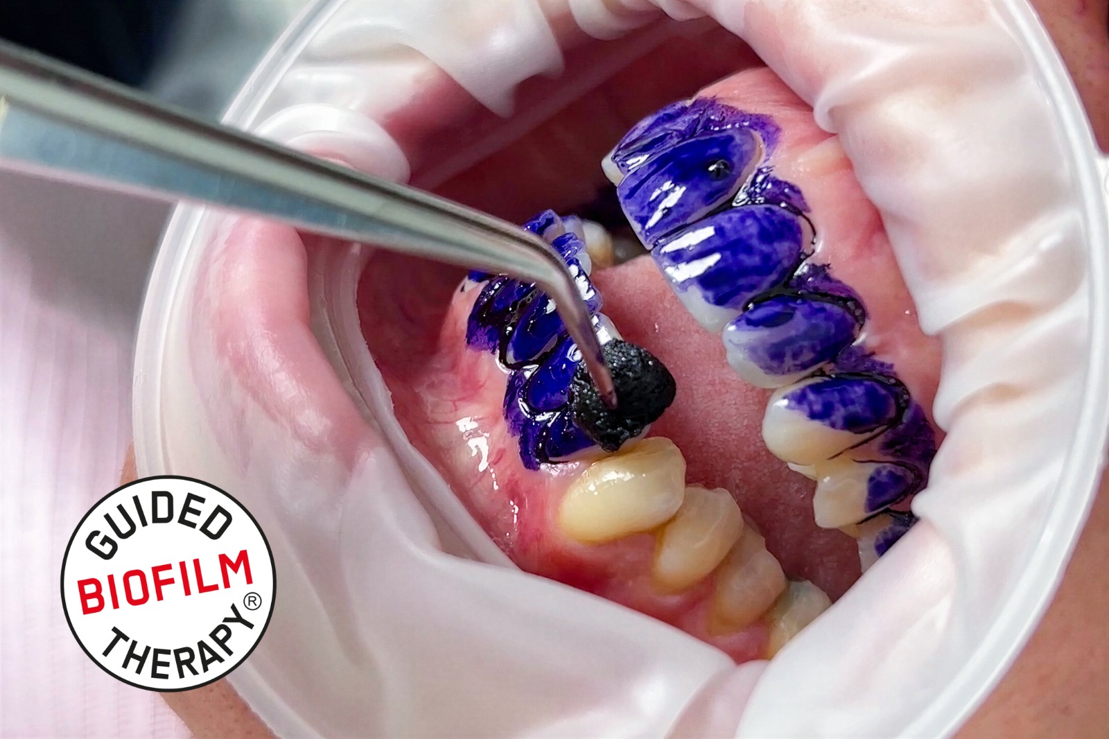 prevenzione-dentale-avanzata-stomadent-trapani-dentista